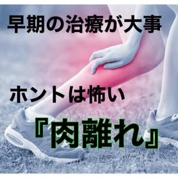 急な運動に起こりやすい！～肉離れ～