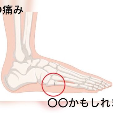 【足の痛み　八女市　整骨院】　といえば！　げんき整骨院!!